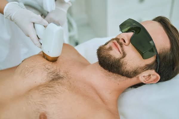 Laser Hair Removal in Mohali